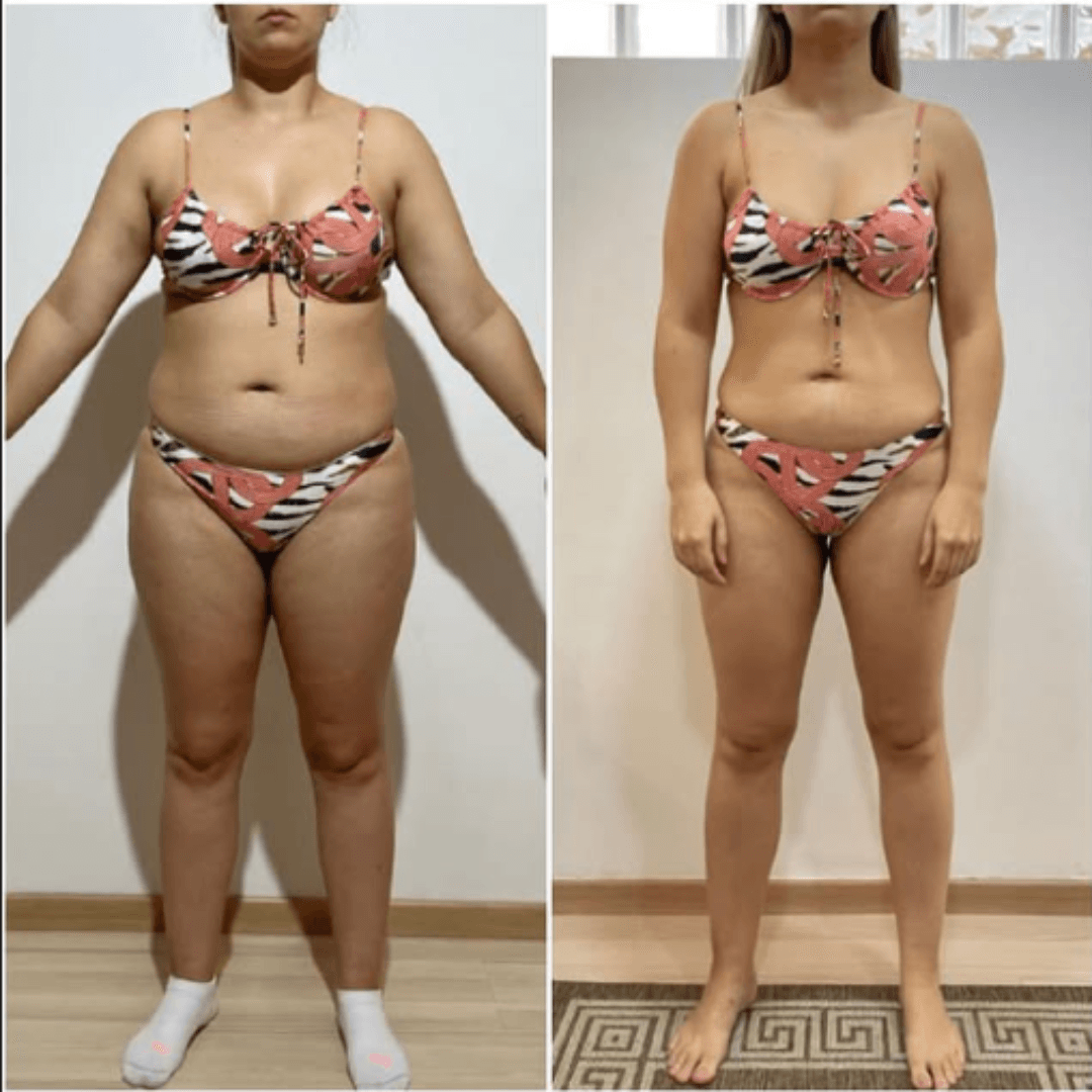 Resultado real antes e depois — participante 4