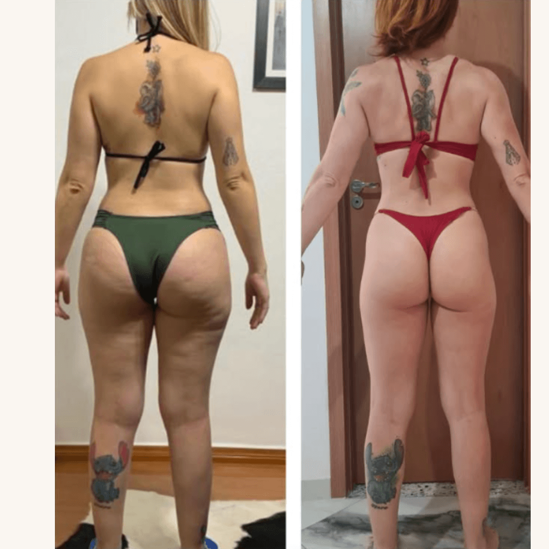 Resultado real antes e depois — participante 6